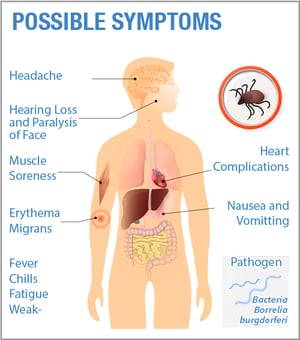 What are the symptoms of Lyme disease