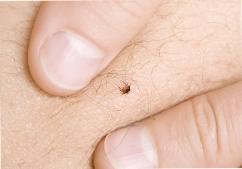 How to diagnose Lyme Disease