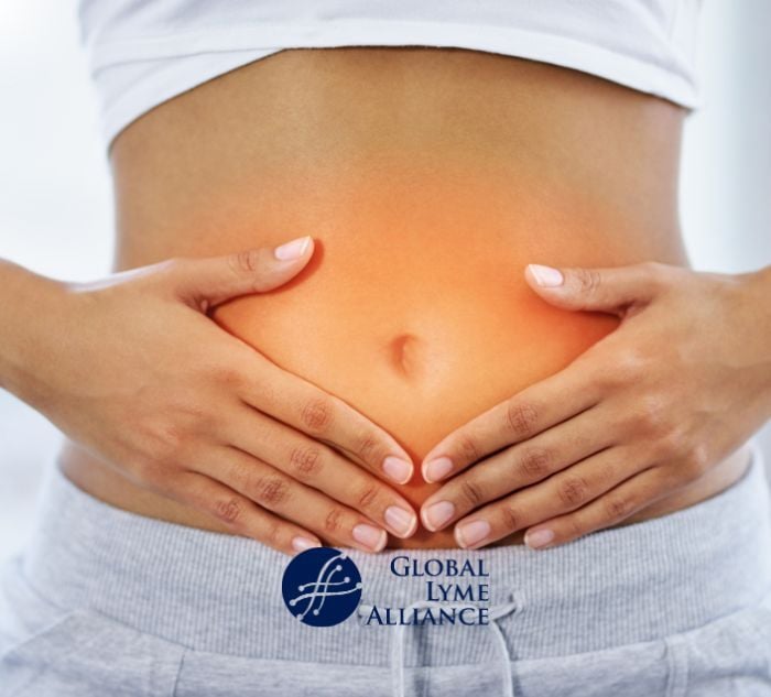 Gut health and Lyme disease 