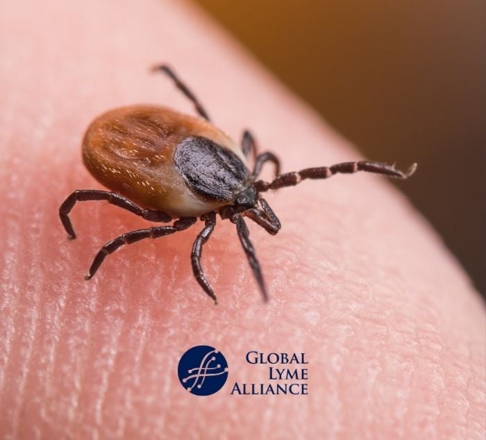 <span id="hs_cos_wrapper_name" class="hs_cos_wrapper hs_cos_wrapper_meta_field hs_cos_wrapper_type_text" style="" data-hs-cos-general-type="meta_field" data-hs-cos-type="text" >Ticks are Everywhere. Don’t Believe Me? I was Bitten in My Own Bed.</span>